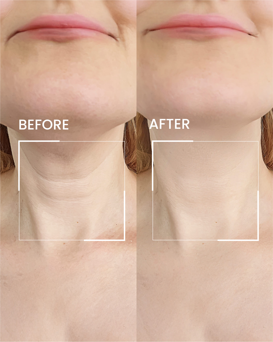 Elire Neck Cream