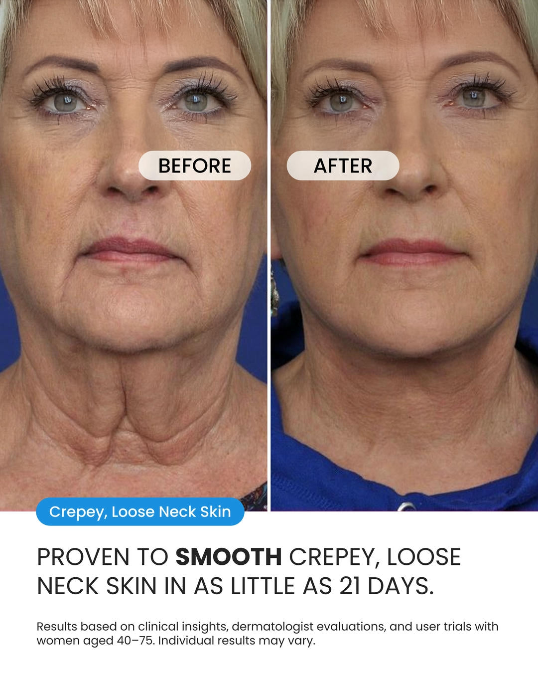 Neck Cream (OCU)