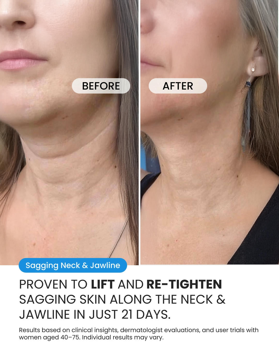 Neck Cream (OCU)