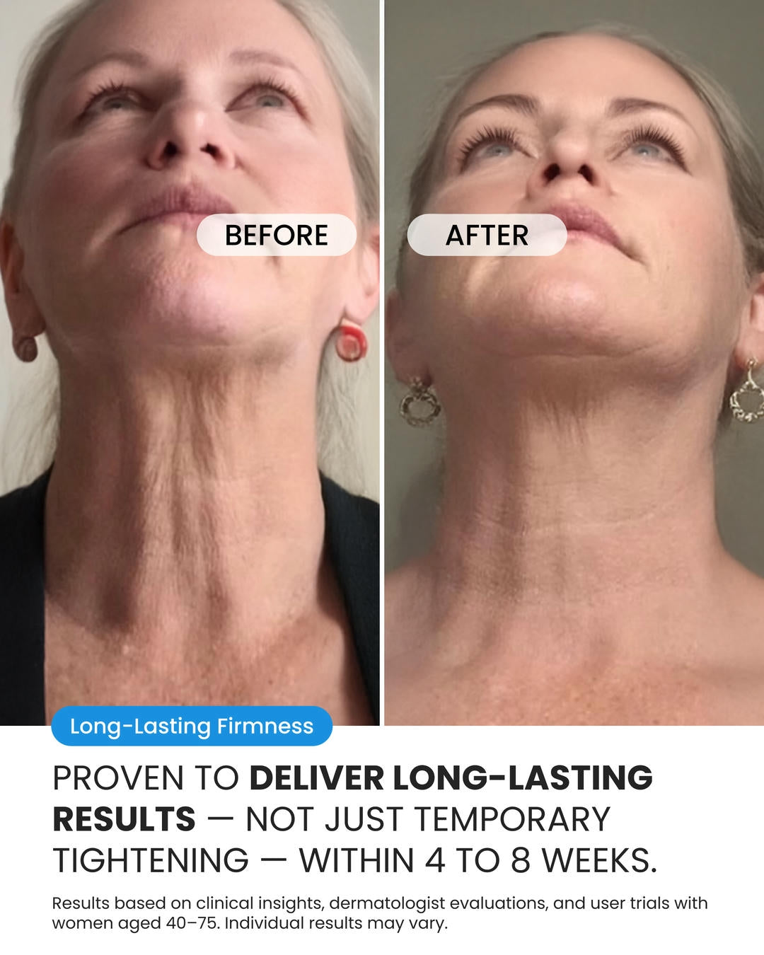 Neck Cream (OCU)