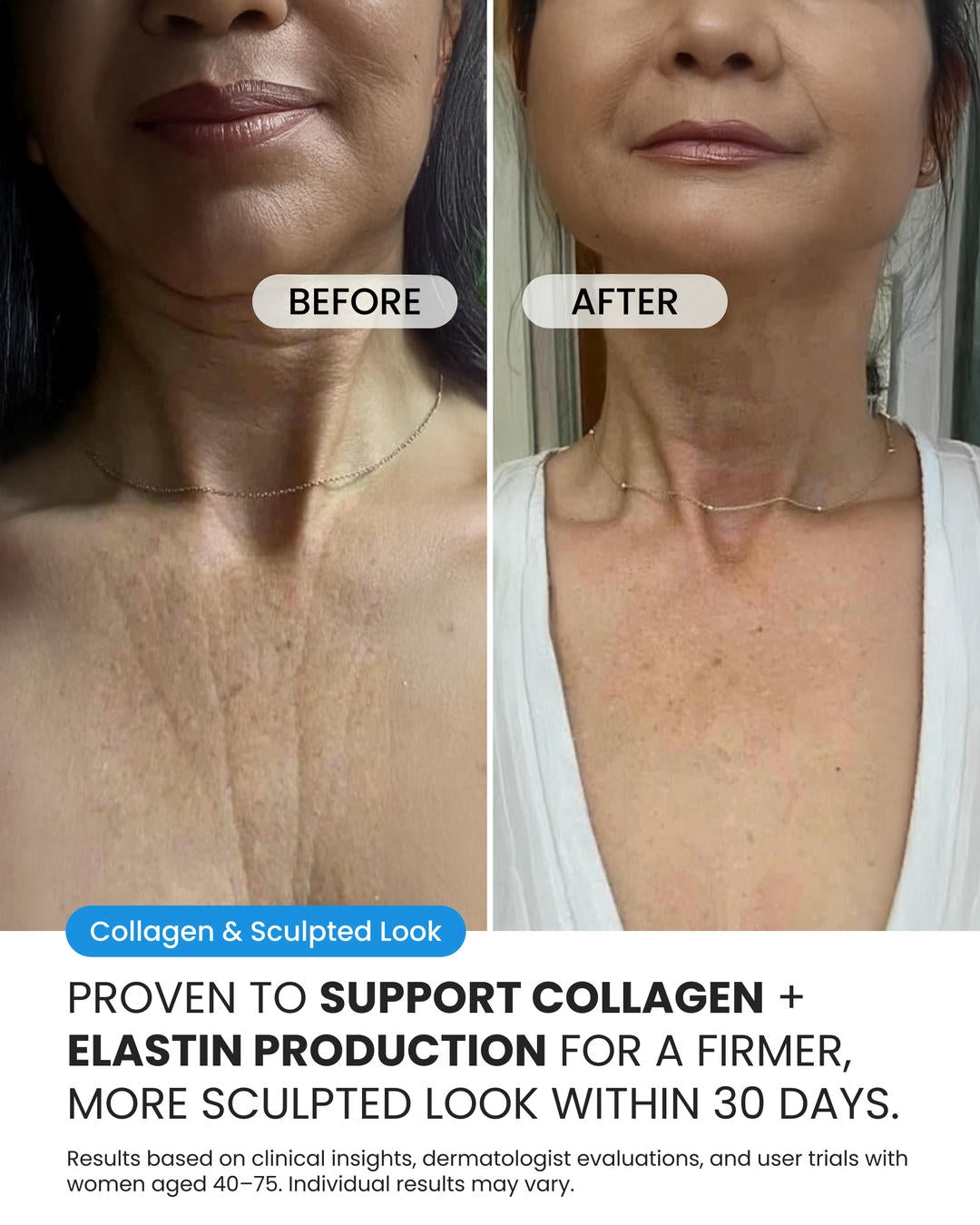 Neck Cream (OCU)