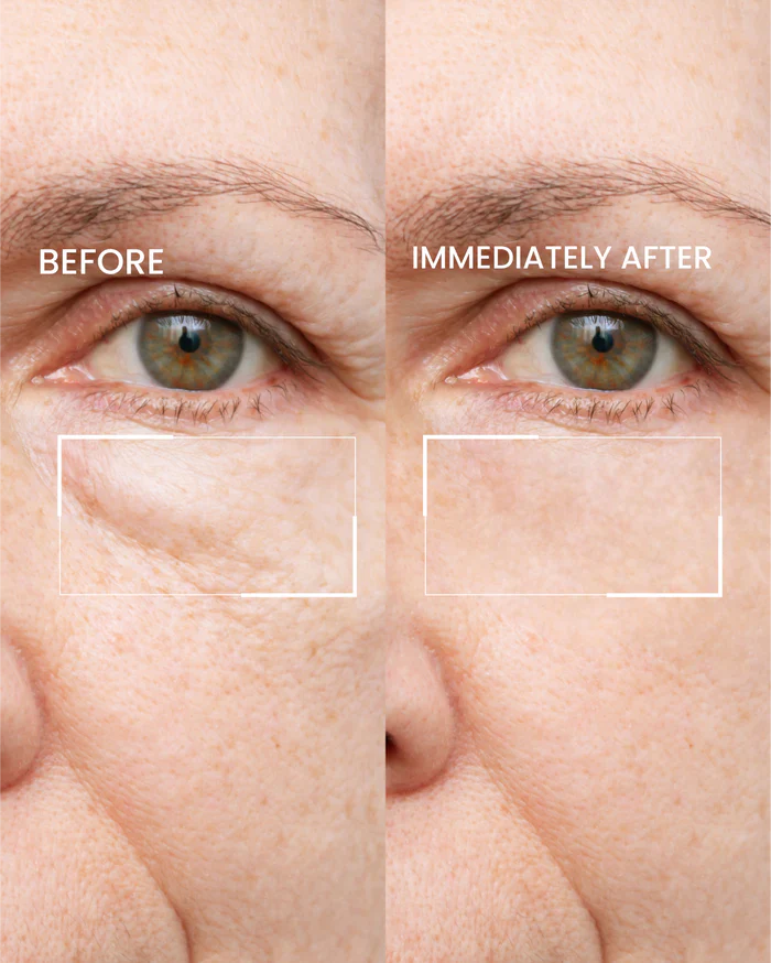 Firming Eye Cream