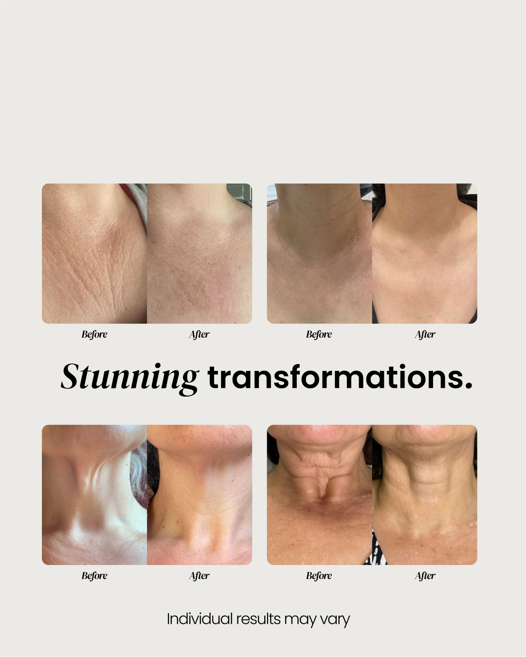 Elire Neck Cream
