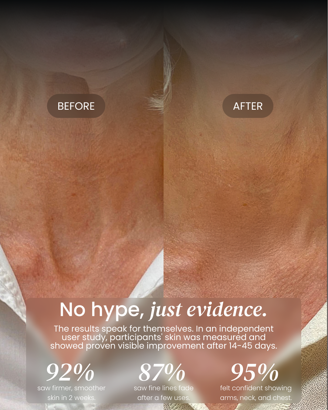 Neck Cream (OCU)
