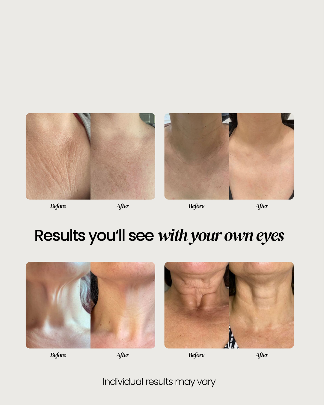Neck Cream (OCU)