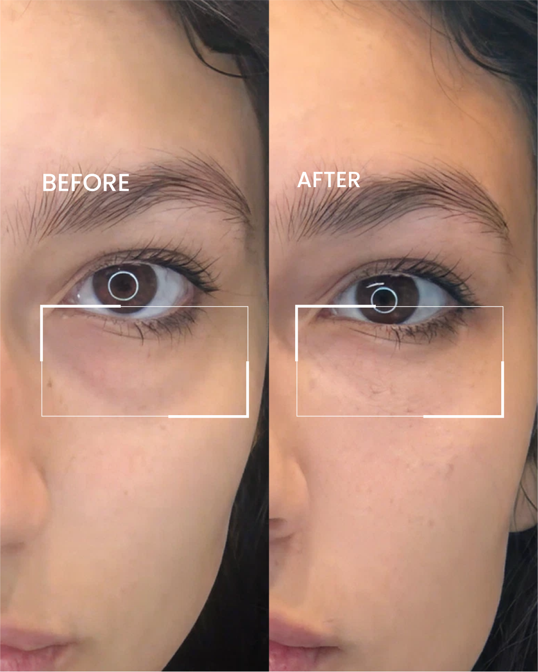 Repair Eye Cream